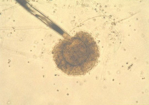 垃圾填埋場發現真菌已進化成會吃塑膠的生物