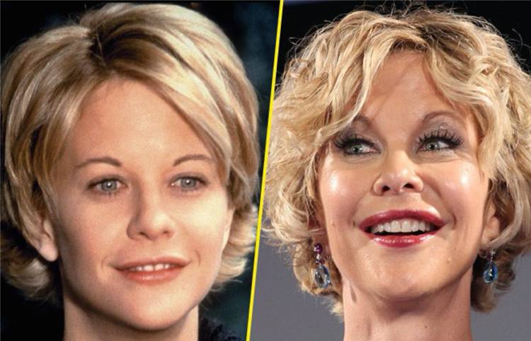 14個光速衰老的好萊塢明星今昔大對比，整形卻整的更壞