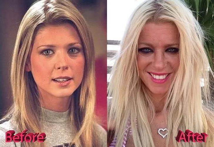 14個光速衰老的好萊塢明星今昔大對比，整形卻整的更壞