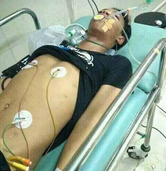 14歲少年被自己眼鏡王蛇咬到拍照炫耀，12小時后慘死