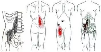 瑜珈大師解釋人T里靈魂的肌肉是造成生理疼痛的主因！