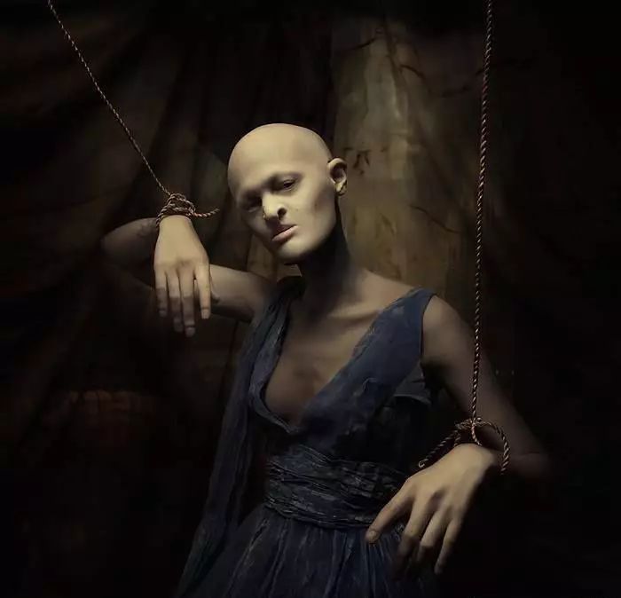 28歲患有罕見基因異常疾病的女模打破了眾人對時尚的印象