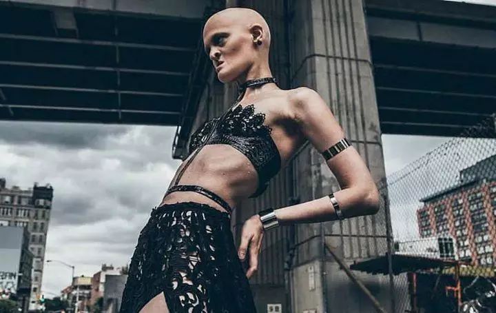 28歲患有罕見基因異常疾病的女模打破了眾人對時尚的印象