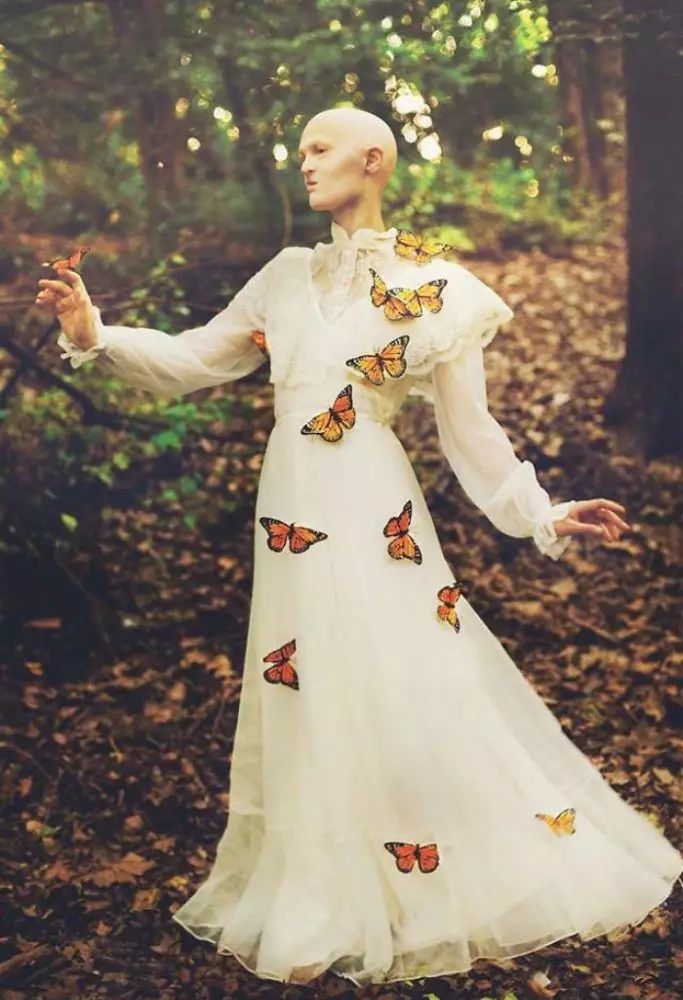 28歲患有罕見基因異常疾病的女模打破了眾人對時尚的印象