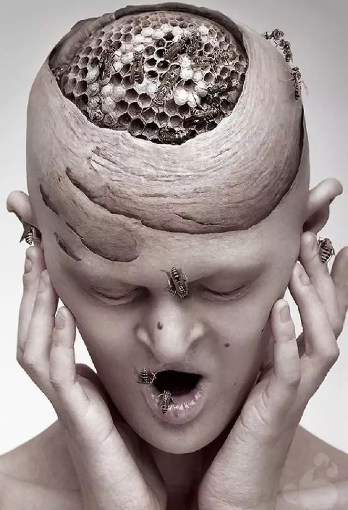 28歲患有罕見基因異常疾病的女模打破了眾人對時尚的印象